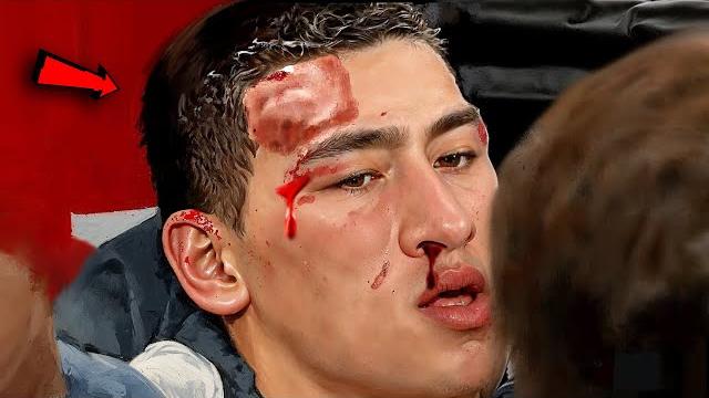 Это Нечто! Бой Где Дмитрий Бивол Был на Грани Это Нечто! Бой Где Дмитрий Бивол Был на Грани