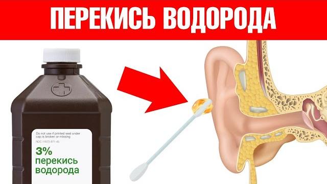 9 необычных способов применения перекиси водорода 9 необычных способов применения перекиси водорода