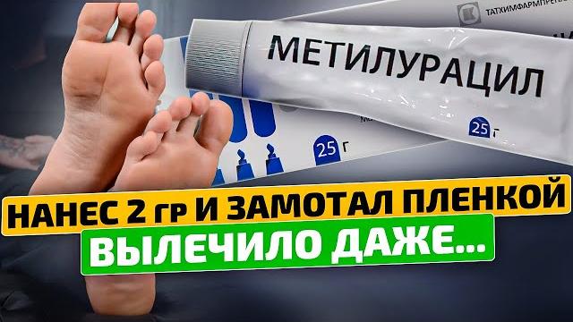Вы ахнете узнав на что способна мазь Метилурацил! Вы ахнете узнав на что способна мазь Метилурацил!