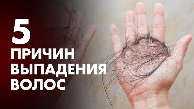 5 ПРИЧИН ВЫПАДЕНИЯ ВОЛОС | Клиника Online 5 ПРИЧИН ВЫПАДЕНИЯ ВОЛОС | Клиника Online