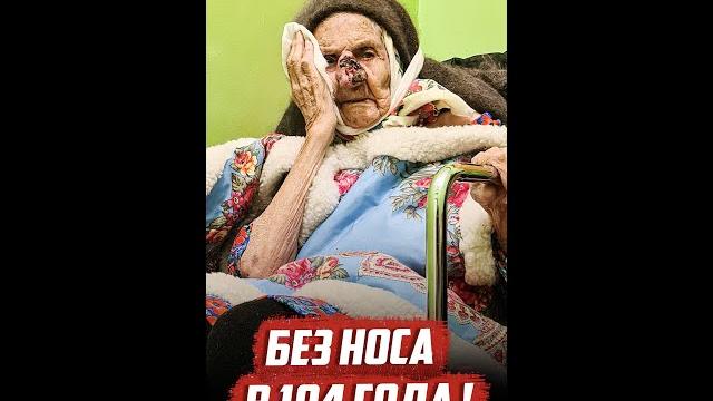 Отвалился нос у бабушки #shorts Отвалился нос у бабушки #shorts