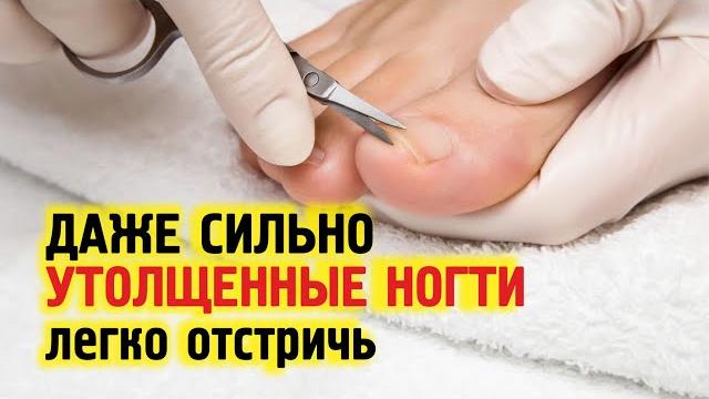 СЕКРЕТ как постричь толстые и жесткие ногти на ногах. Узнайте как размягчить ногти сделать тонкими СЕКРЕТ как постричь толстые и жесткие ногти на ногах. Узнайте как размягчить ногти сделать тонкими
