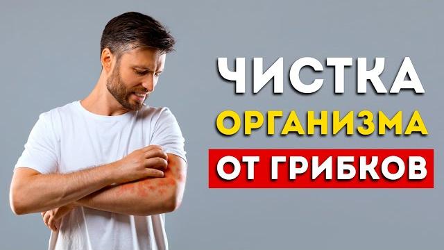 Избавляем организм от грибков (Это надо знать каждому) Избавляем организм от грибков (Это надо знать каждому)