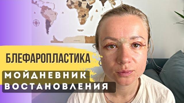 Восстановление после блефаропластики по дням. Блефаропластика результат после 9 месяцев Восстановление после блефаропластики по дням. Блефаропластика результат после 9 месяцев
