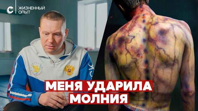 «Был вход через голову, выход через ногу». Пережил удар молнии «Был вход через голову, выход через ногу». Пережил удар молнии