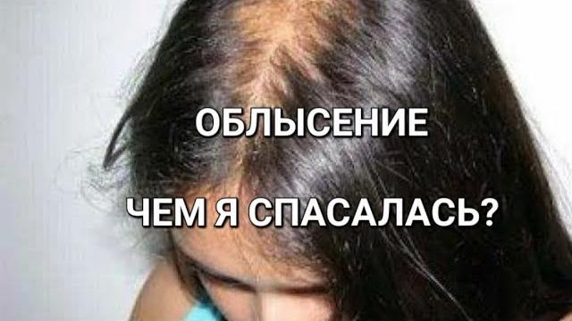 ВЫПАДЕНИЕ ВОЛОС у женщин ВЫПАДЕНИЕ ВОЛОС у женщин