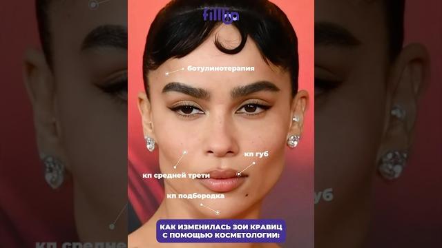 Как изменилась Зои Кравиц с помощью косметологии! #косметология #знаменитости #голливуд #зоикравиц Как изменилась Зои Кравиц с помощью косметологии! #косметология #знаменитости #голливуд #зоикравиц