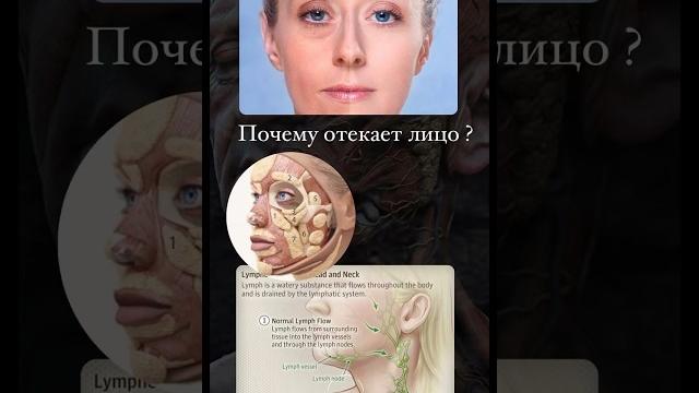 Почему отекает лицо ? Причины Почему отекает лицо ? Причины