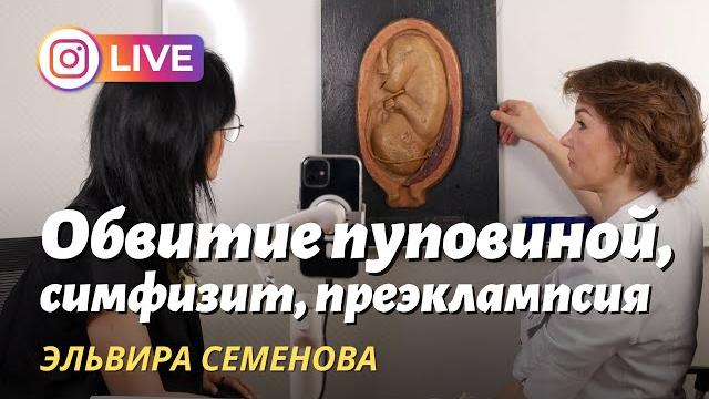 Предлежание плаценты, обвитие пуповиной, преэклампсия. Акушер-гинеколог и врач УЗД Эльвира Семенова Предлежание плаценты, обвитие пуповиной, преэклампсия. Акушер-гинеколог и врач УЗД Эльвира Семенова