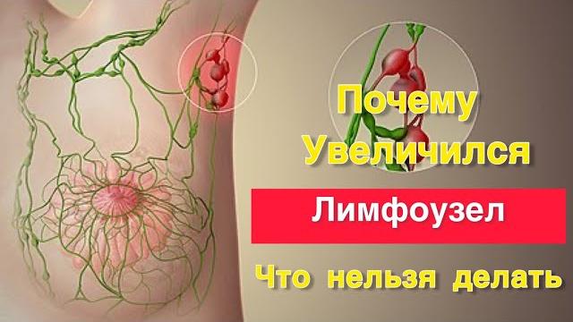 Почему увеличился лимфоузел. Что делать нельзя Почему увеличился лимфоузел. Что делать нельзя