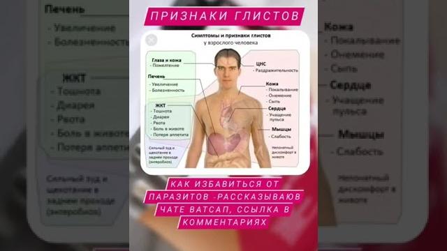 Признаки глистов у взрослого человека Признаки глистов у взрослого человека