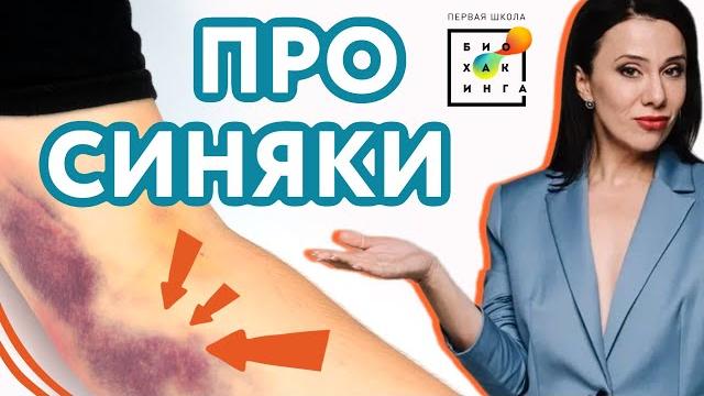 Почему появляются синяки без причин? Почему появляются синяки без причин?