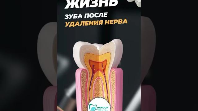 ЖИЗНЬ ЗУБА ПОСЛЕ УДАЛЕНИЯ НЕРВА. @DANDON_TJ ЖИЗНЬ ЗУБА ПОСЛЕ УДАЛЕНИЯ НЕРВА. @DANDON_TJ