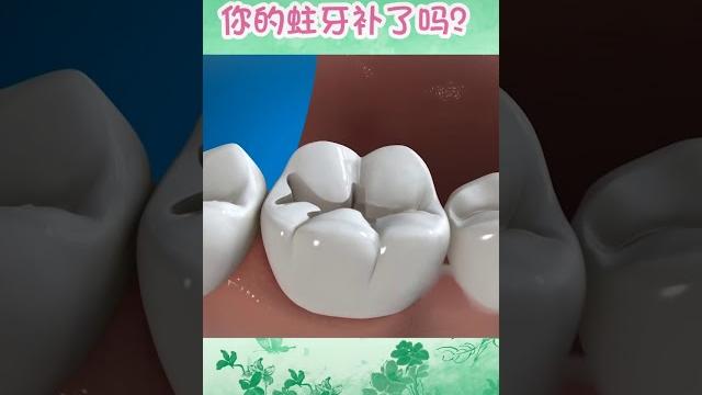 Как лечат кариес и ставят пломбы у нас в стоматологии! Как лечат кариес и ставят пломбы у нас в стоматологии!