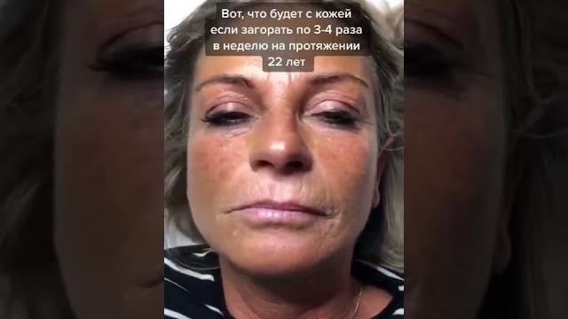 Вот почему я против солярия... Вот почему я против солярия...