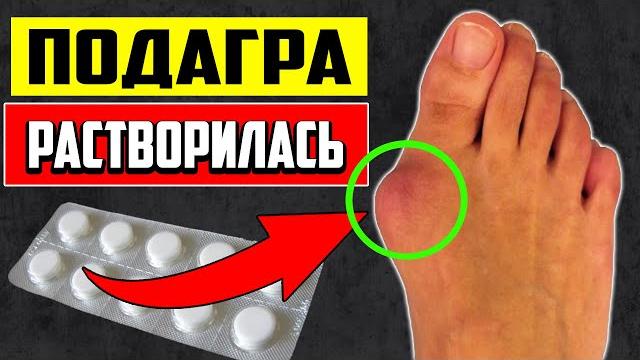 Эти ГЕНИАЛЬНЫЕ ТАБЛЕТКИ Рассасывают ПОДАГРУ на ногах без остатка. Подагра на суставах лечение. Эти ГЕНИАЛЬНЫЕ ТАБЛЕТКИ Рассасывают ПОДАГРУ на ногах без остатка. Подагра на суставах лечение.