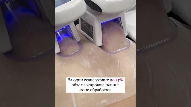Криолиполиз живота на аппарате S15. В наличии в Эстетик! Заказывайте на сайте estetik-online.ru Криолиполиз живота на аппарате S15. В наличии в Эстетик! Заказывайте на сайте estetik-online.ru