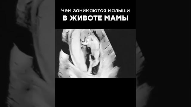 Чем занимаются малыши в животе мамы Чем занимаются малыши в животе мамы