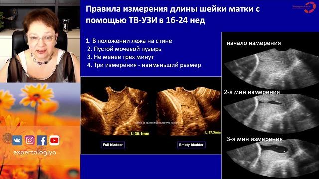 Экспертология | Короткая шейка матки 2. Ответы на вопросы Экспертология | Короткая шейка матки 2. Ответы на вопросы