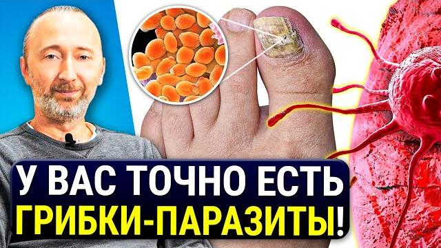 Грибки в организме вызывают РАК! Мощные средства и методики лечения от всех ГРИБКОВ - паразитов! Грибки в организме вызывают РАК! Мощные средства и методики лечения от всех ГРИБКОВ - паразитов!