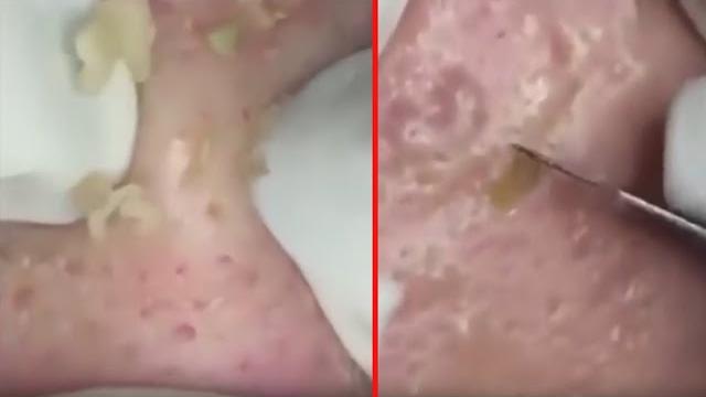 BESTПРЫЩ/ ДАВИМ КУЧУ ЧЕРНЫХ ТОЧЕК BESTПРЫЩ/ ДАВИМ КУЧУ ЧЕРНЫХ ТОЧЕК