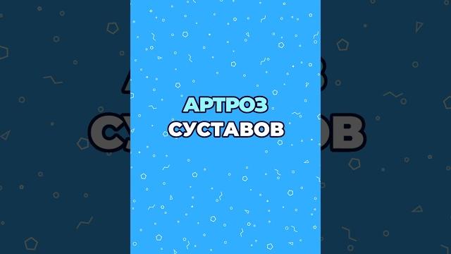 Артроз суставов #шишонин #здоровье #артроз #суставы Артроз суставов #шишонин #здоровье #артроз #суставы