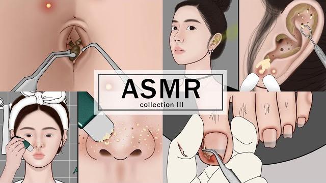 ASMR Body Treatments! Navel Stone, Ingrown Toenail, Ear Cleaning, Blackheads | Meng's Stop Motion ASMR Body Treatments! Navel Stone, Ingrown Toenail, Ear Cleaning, Blackheads | Meng's Stop Motion