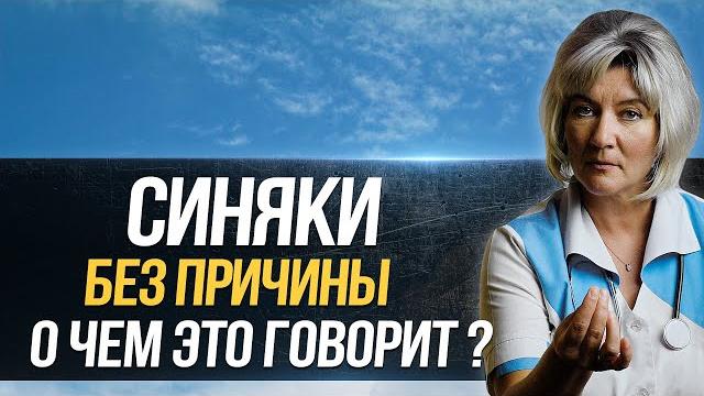 Почему появляются синяки на теле без причины, о чем это говорит, что делать и чем может быть опасно? Почему появляются синяки на теле без причины, о чем это говорит, что делать и чем может быть опасно?