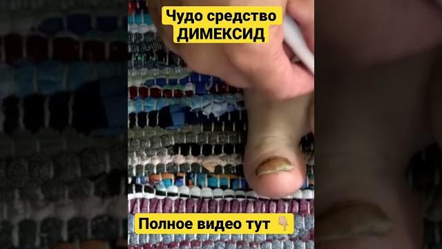 Польза димексида #здоровье #димексид Польза димексида #здоровье #димексид