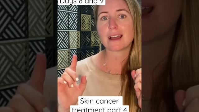 Fluorouracil skin cancer treatment part 4 Fluorouracil skin cancer treatment part 4