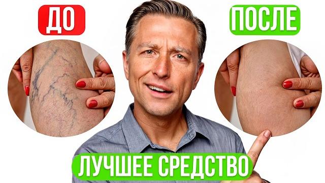 Варикоз на ногах и сосудистые звездочки? Средство от варикоза №1 Варикоз на ногах и сосудистые звездочки? Средство от варикоза №1
