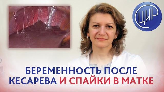 Беременность после кесарева. Когда беременеть после кесарева и что делать со спайками в матке? Беременность после кесарева. Когда беременеть после кесарева и что делать со спайками в матке?