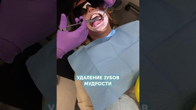 Удаляем зубы мудрости #shorts Удаляем зубы мудрости #shorts