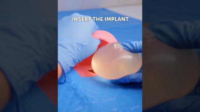 My surgeon learned from 5 minute crafts videos My surgeon learned from 5 minute crafts videos
