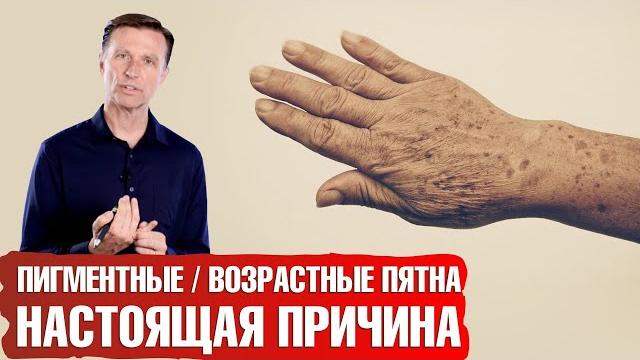 Возрастные пигментные пятна. Как избавиться от печеночных пятен Возрастные пигментные пятна. Как избавиться от печеночных пятен