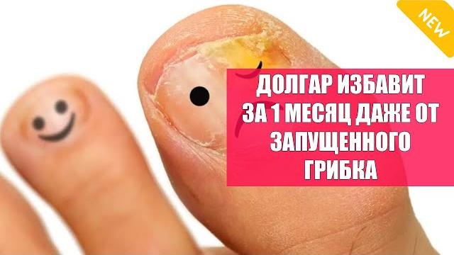 Грибок на коже ступней мазь Грибок на коже ступней мазь