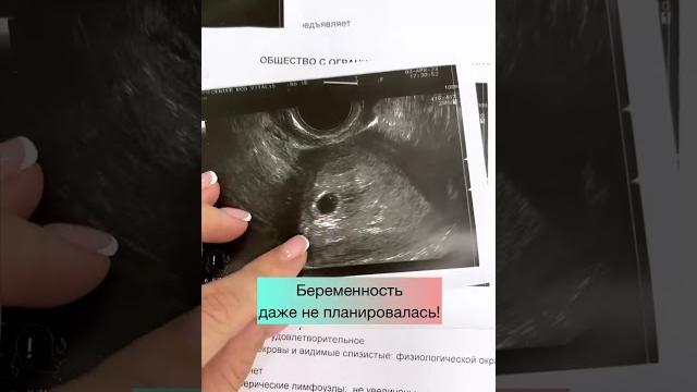Преждевременное истощение яичников Преждевременное истощение яичников