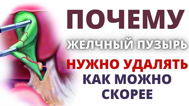 Почему нужно удалять желчный пузырь как можно скорее! Нашли камень в желчном пузыре - что делать? Почему нужно удалять желчный пузырь как можно скорее! Нашли камень в желчном пузыре - что делать?