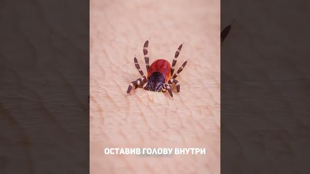 Как удалить клеща #клещи #удалитьклеща #жизненно #знаетеливычто #каждому #клещ #будьлучше #важное Как удалить клеща #клещи #удалитьклеща #жизненно #знаетеливычто #каждому #клещ #будьлучше #важное