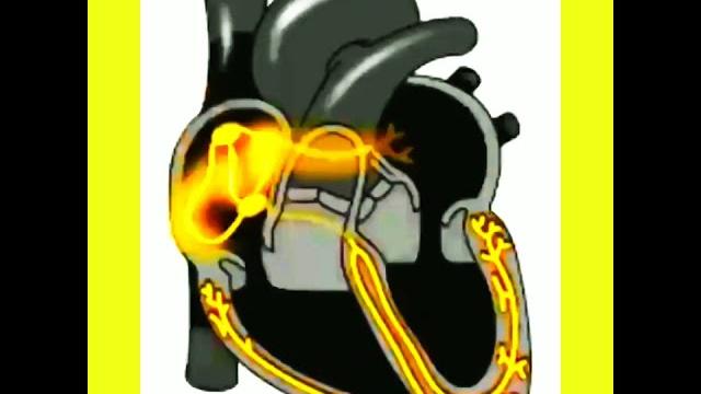 Electrical impulses of heart Electrical impulses of heart