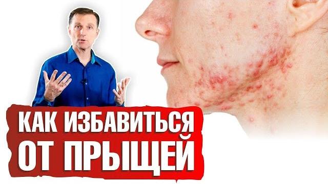 Как избавиться от прыщей? Как избавиться от прыщей?