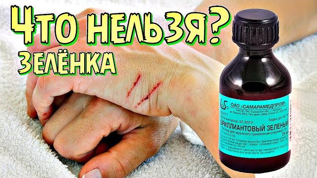 Какие раны запрещено мазать зеленкой? Какие раны можно обработать зеленкой? Зеленка применение Какие раны запрещено мазать зеленкой? Какие раны можно обработать зеленкой? Зеленка применение