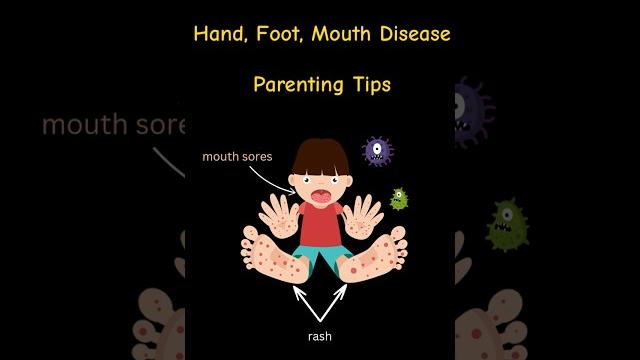 Manage it Like a Pro: Hand, Foot, and Mouth Disease. #ParentingTips #ChildHealth #viralshort Manage it Like a Pro: Hand, Foot, and Mouth Disease. #ParentingTips #ChildHealth #viralshort