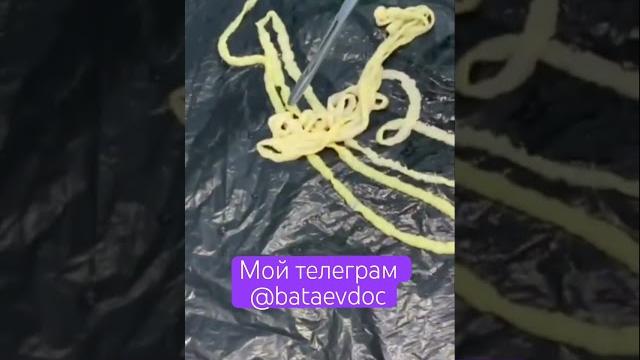 #Паразиты #паразитолог #Паразиты #паразитолог