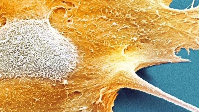 Why Don't We All Have Cancer? Why Don't We All Have Cancer?