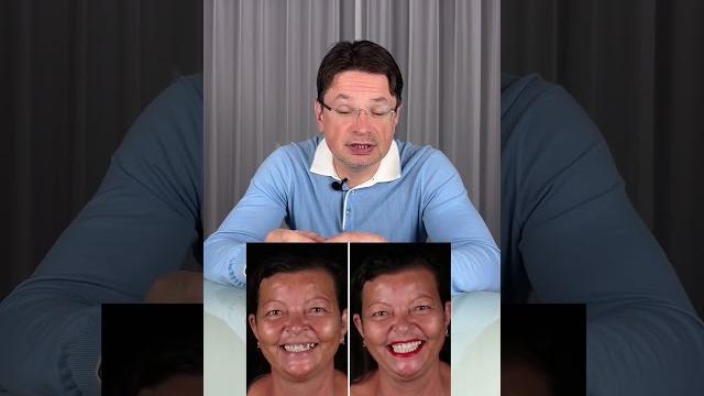 Что будет, если НЕ вставлять зубной имплант?Ссылка в комментариях #стоматология #shorts #имплантация Что будет, если НЕ вставлять зубной имплант?Ссылка в комментариях #стоматология #shorts #имплантация