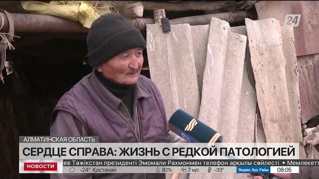 Сердце справа: жизнь с редкой патологией Сердце справа: жизнь с редкой патологией