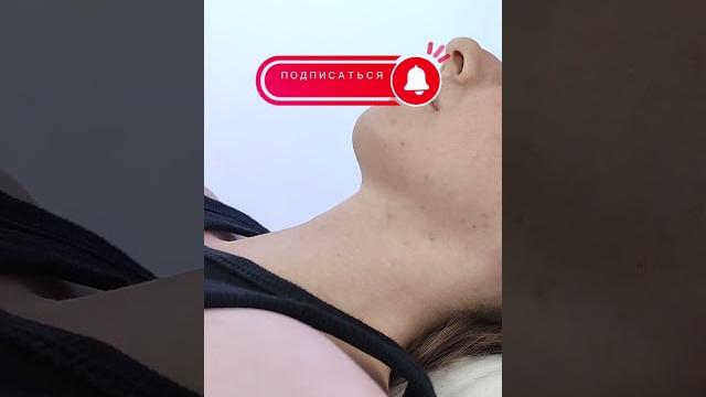 Икота? Попробуйте акупунктурную точку #здоровье #китайскаямедицина #иглоукалывание #икота Икота? Попробуйте акупунктурную точку #здоровье #китайскаямедицина #иглоукалывание #икота