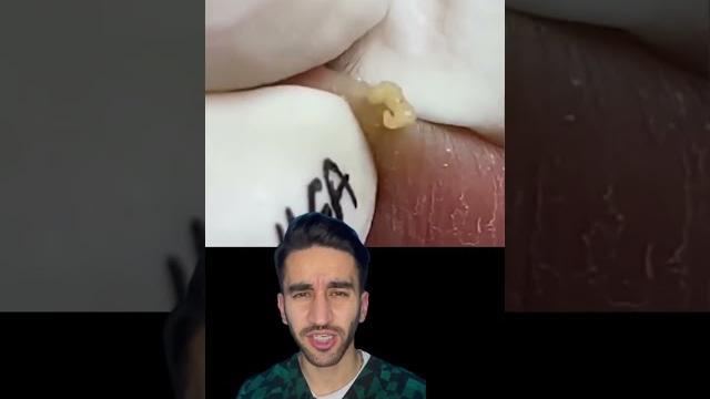 механическая чистка лица механическая чистка лица