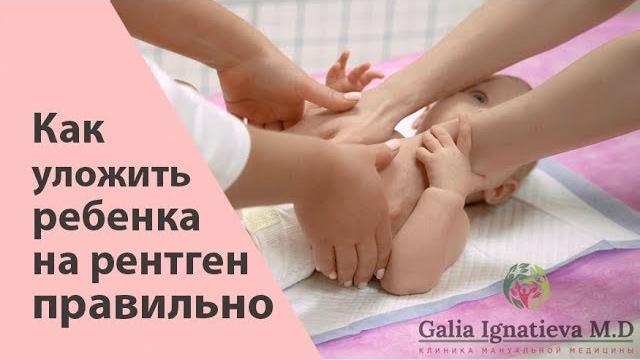 Как держать ребенка во время рентгена / Цифровой рентген ТБС грудничкам - Галина Игнатьева Как держать ребенка во время рентгена / Цифровой рентген ТБС грудничкам - Галина Игнатьева